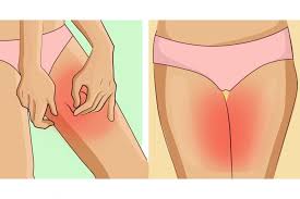 Con Questi 7 Trucchi Le Irritazioni Non Saranno Pie Un Problema Il Vostro Interno Coscia Vi Ringraziera