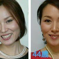 美容整形不要 シワとたるみを改善できる顔体操教室 美容整形 顔 ビューティーアドバイス