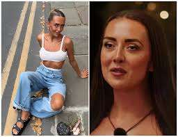 Holly's dramatic appearance change after plastic surgery