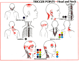 38 Precise Headache Pressure Points Chart