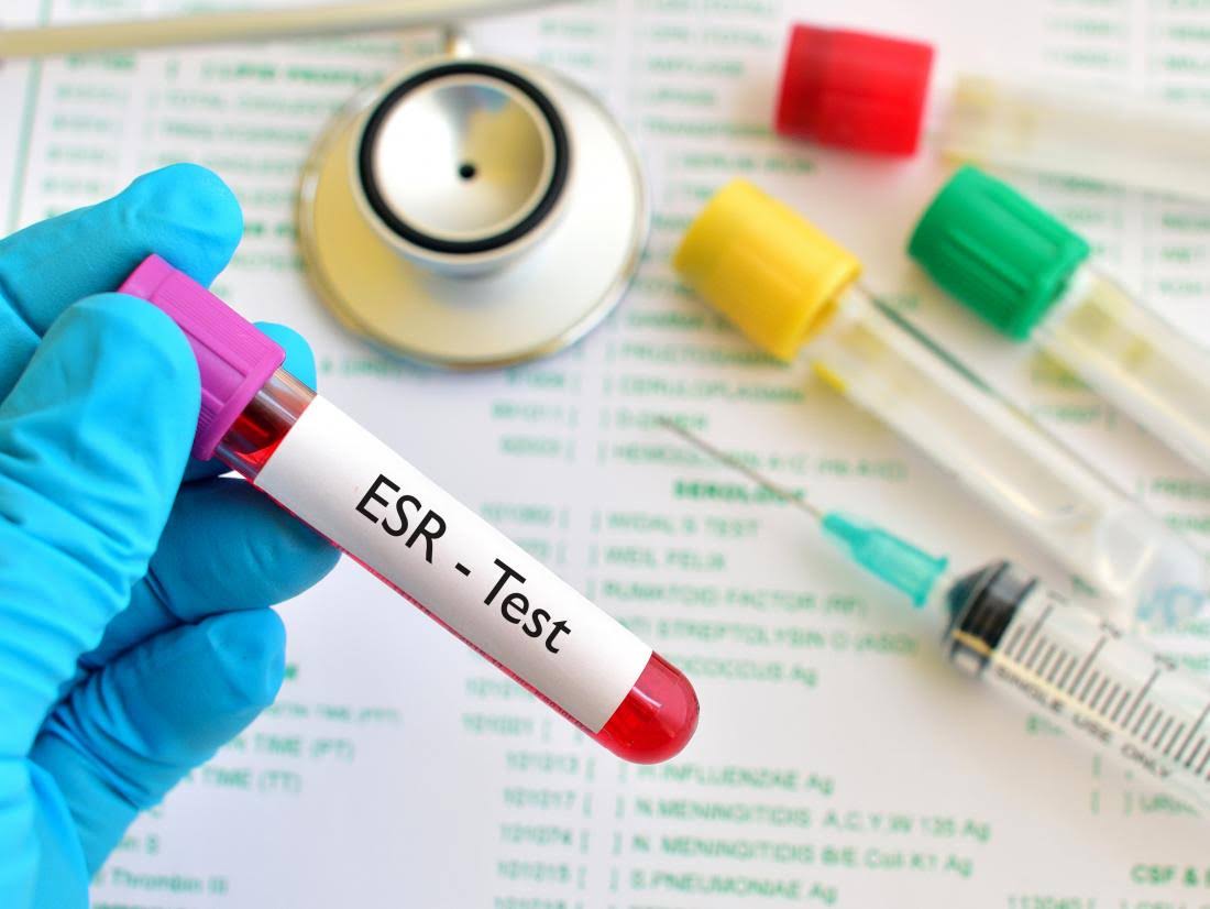 ESR product image