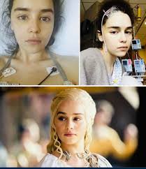 Actress hides brain aneurysm while filming Game of Thrones