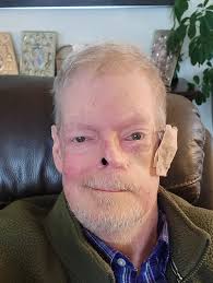 I start Keytruda in two weeks and am nervous about the side-effects. I'm a  high school special education teacher so I'm very busy and I feel bad about  taking time off or