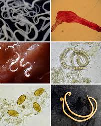 Image result for Whipworm