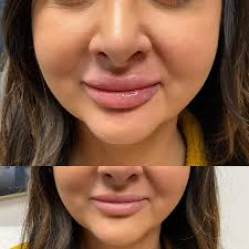 Brightside Aesthetics