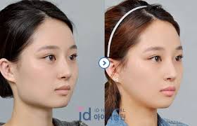 Place the jaw clip over the twisted section to secure the look in place. Sucks For The People Who Got Trendy Plastic Surgery Kpopandkimchi Beauty Kpop Kpop Plasticsurgery Vingle Interest Network