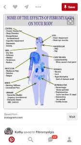 Pin On Health Fitness