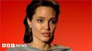 Beating breast cancer with gene testing