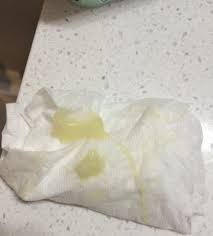 Tmi I Think I Lost My Mucus Plug Babycenter