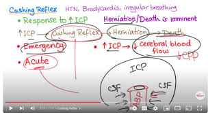 Image result for Cushing Response