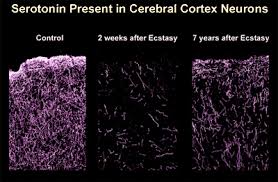 The same doses of ecstasy may no longer produce the same effects, so users may need to increase their doses to experience those effects. Neuroscience For Kids Mdma Ecstasy