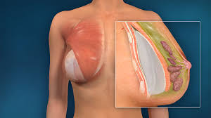 Image result for Breast Augmentation