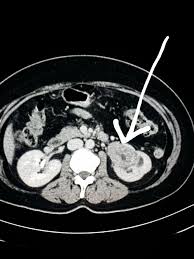 Pin By Cerridwen Macleod On Computed Tomography Ct Pet Ct Diagnostic Imaging Radiology