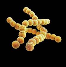 Image result for Streptococcus