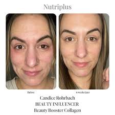 What collagen is everyone using ?