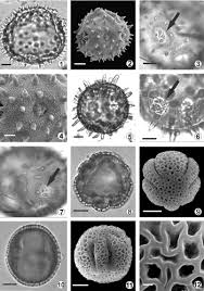 Image result for Paropsia