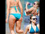 Extreme Severe Cellulite