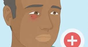 How to Treat a Wound: 10 Steps (with Pictures)