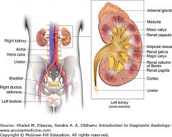 Genitourinary System Radiology Key