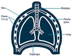 A number of prognostic tools have been developed to try explain these variations and to . Mesothelioma Claims Mesothelioma Claims Uk Mesothelioma Claim National Asbestos Helpline