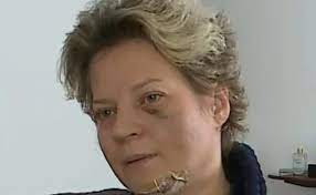 Sem provas, o presidente jair bolsonaro voltou a citar que houve fraude nas eleições de 2018 e criticou o stf. Policia Descarta Agressao A Joice Hasselmann E Diz Que Deputada Caiu