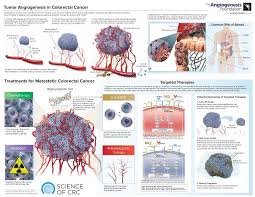 Multimedia The Angiogenesis Foundation