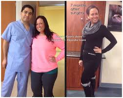 Weight Loss Surgery 101 Requirements More Vida