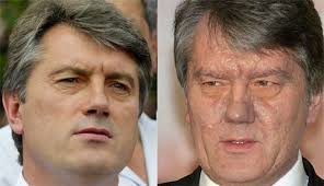 Schläfrigkeit, reizbarkeit, appetitlosigkeit und häufig gewichtsverlust treten auf. Juschtschenkos Therapie Nzz