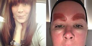 We have entered the contrast reaction in your medical record at memorial sloan kettering (msk). This Is What A Bad Reaction To Microblading Looks Like Microblading Horror Stories