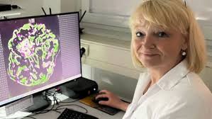 Weltneuheit aus Greifswald: Nierenerkrankung kann berechnet werden