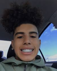 Pin By Andry Cordoba On Brace Face Light Skin Boys Cute Braces Colors Cute Braces
