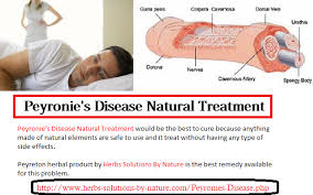 Peyronies Disease Induced Info