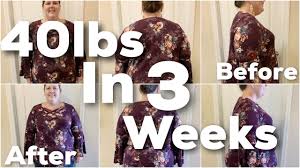 Losing 40 Pounds In 3 Weeks My Bariatric Surgery Story And Gastric Sleeve Results Youtube