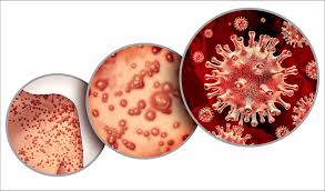 Our Statement on Monkeypox: Infection, Vaccines, and Treatment for Pregnant  or Breastfeeding Women | InfantRisk Center