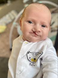 Danielle Orton is fundraising for Cleft Lip And Palate Association