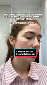 4 Diferentes Tratamientos de Piel en un Día