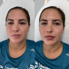 Glow St Pete MedSpa added a new...