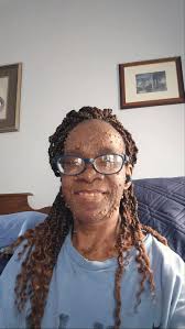 Okay I lost the post of someone sharing a mask withnerophibromatosis