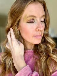 I'm back…asking about eye protection again 🤓. I recently got this black  eye from pickleball—not a ball to the eye but paddle to the brow 🤕  ouuuuch. I was very lucky. Could