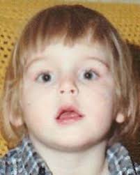 Doctors can only confirm this diagnosis after the mass is removed. Andrew Amato Mickey Mouse T Shirt Andrew Baby Face