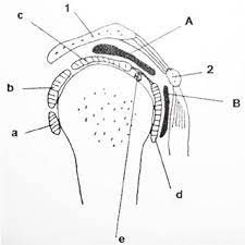 Download scientific diagram | bigliani ' s classification of acromion undersurface with corresponding supraspinatus outlet view radiograph. Classification Of The Acromial Morphology According To Bigliani Et Al Download Scientific Diagram