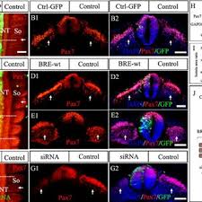 Maybe you would like to learn more about one of these? Somite Differentiation Is Affected By Misexpressing Bre In Neural Tube Download Scientific Diagram