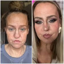 Dr. Thomas Romo III (@drthomasromo) • Instagram photos and videos