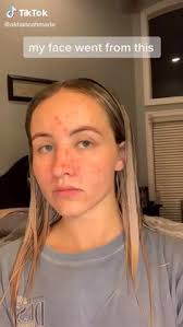 Savannah Dew (glitterkittty)