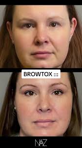 BROWTOX ::: IYKYK, if you don’t, take a look at this subtle refresh