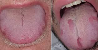Maybe you would like to learn more about one of these? Ù„Ø³Ø§Ù† ÙƒÙˆÙÙŠØ¯ Ø¢Ø®Ø± Ø¥Ø¨Ø¯Ø§Ø¹Ø§Øª Ø§Ù„ÙÙŠØ±ÙˆØ³ ÙˆØ£ØºØ±Ø¨ Ø£Ø¹Ø±Ø§Ø¶Ù‡