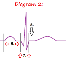 Intended for all medical professionals. Ekg Pqrst Rhythm Strip Wave Quiz Anatomy Pathophysiology
