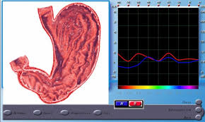 3d Nls Non Linear Diagnostic System Origin Software Free Download Diacom 3d Nls Electronics Technology The Originals System