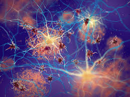 It's also the first treatment that targets an underlying pathology of the disease. Dzne The Long Road To Dementia