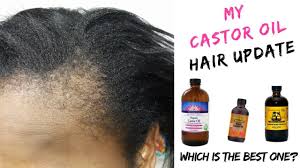 Did you know that the seeds of castor beans contain a very poisonous chemical? Best Castor Oil For Fast Hair Growth Youtube